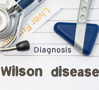 Wilson's Disease - A Pipeline Analysis Report
